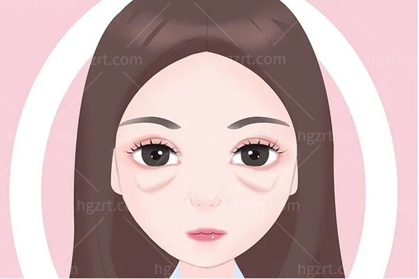 广州曙光去眼袋价差为何大？不开刀术式6200元起，附价格表与选择指南