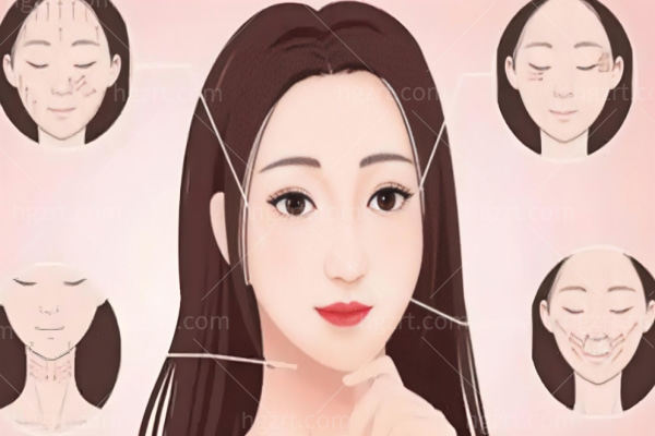 武汉杨蓉做双眼皮技术好吗