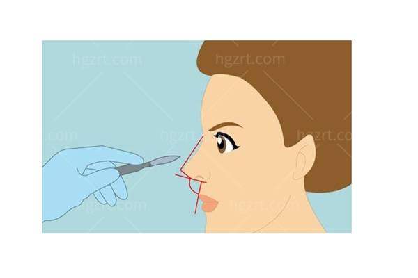 成都艺星周顺波做鼻子技术