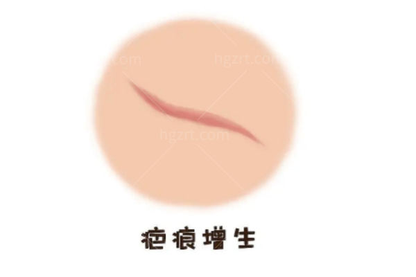 深圳疤痕修复医美机构推荐