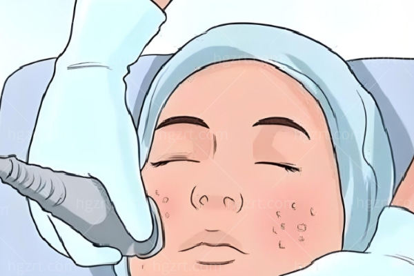 2025杭州黄金微针医院排名,本地人私藏正版五家机构对比速约! 