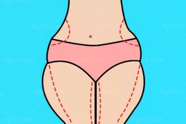 大腿抽脂多少钱