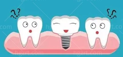 50-60岁种牙2026价格表