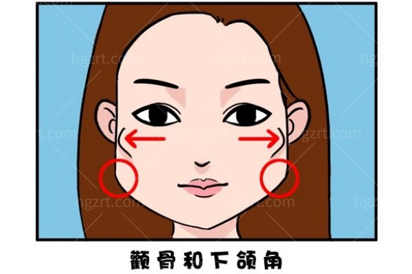 颧骨内推手术是怎么做的？颧骨内推手术全过程大揭秘：看完这篇你再决定！