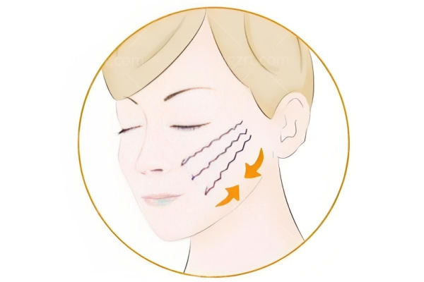 王易彬面部微整提升多少钱