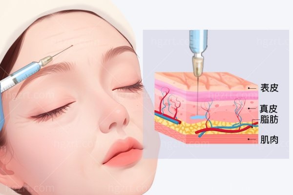 北京加减美面部提升怎么预约