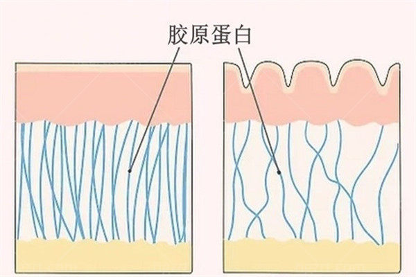 济州岛WITH皮肤科皮肤科Re2o胶原水光｜60万韩币｜弹力再生｜限时体验