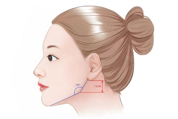 揭秘:下颌骨十个做了九个后悔是因为什么?学会这几点避免失败！