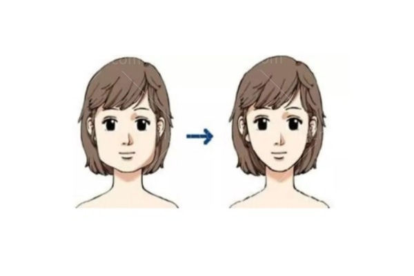 下颌骨十个做了九个后悔是因为什么