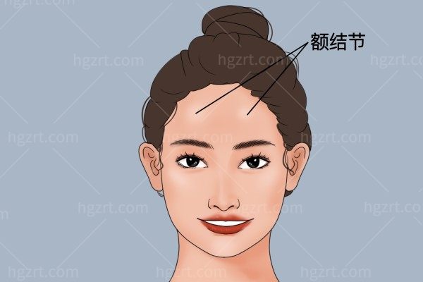 额骨突出怎么矫正？