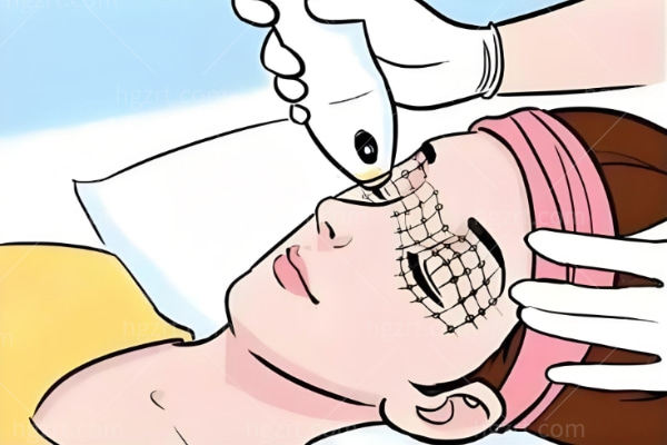 美拉美超声提拉值不值得做?看完这篇科普知识你就明白了！