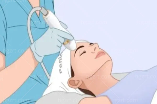 美拉美超声提拉值不值得做