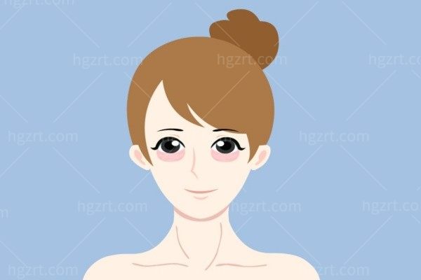 卧蚕脂肪移植多久消肿？