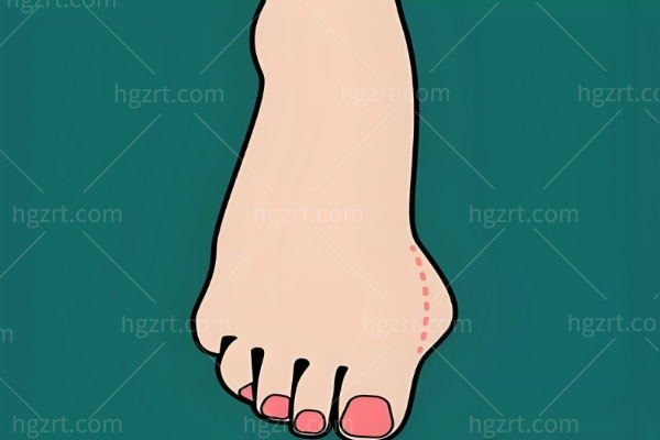 上海拇指外翻哪个医院做的好