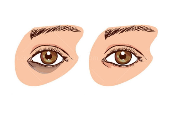 眼修复吕方中技术怎么样