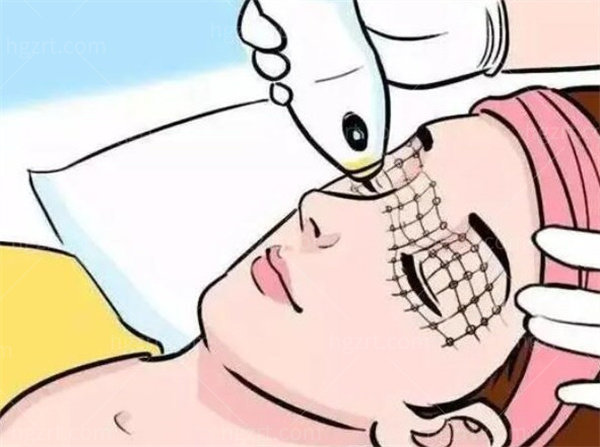 黑金超光子一旦用了就不能停吗