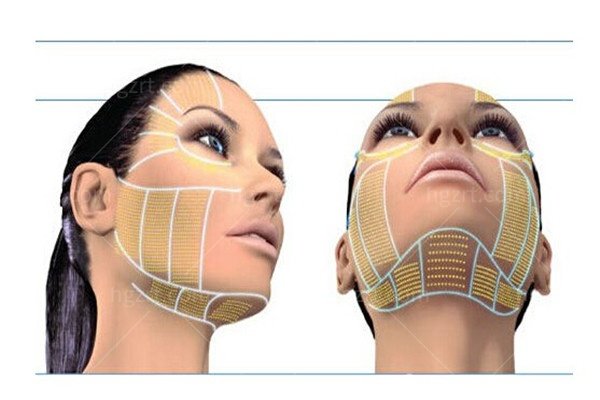 韩国清潭美乐二代美版超声刀300发仅109万韩币！限时优惠来袭，抢购倒计时！