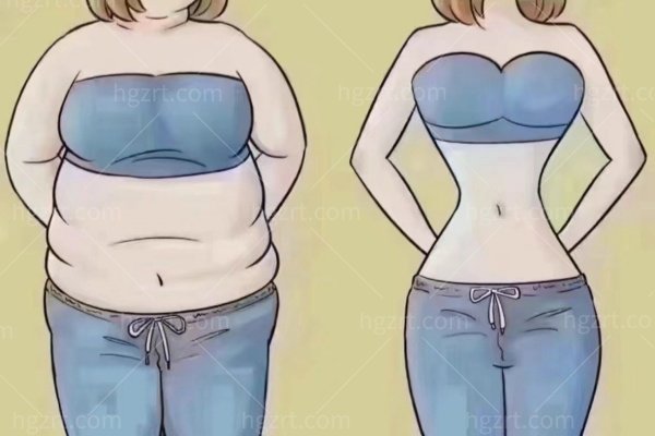 抽脂和体雕是一回事吗