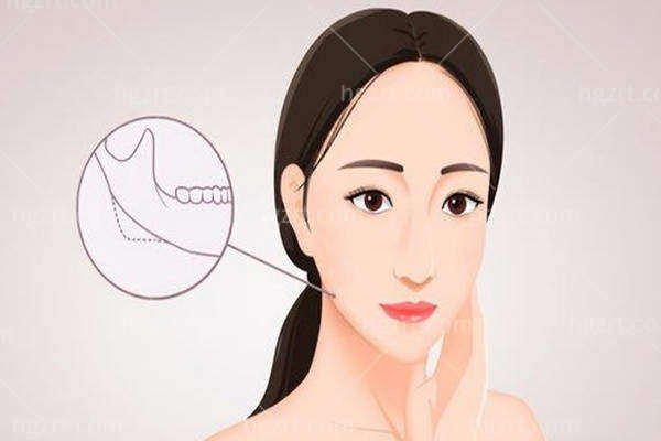 杭州整形医院唐冬生医生：3D人工骨修复的骨干医生