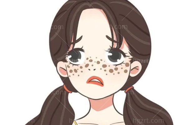 雀斑激光一次多少钱？全面揭秘价格真相，看完这篇再去做！