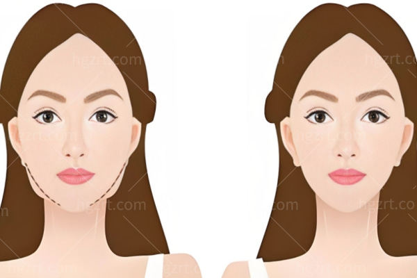 深圳颂美整形医院怎么样