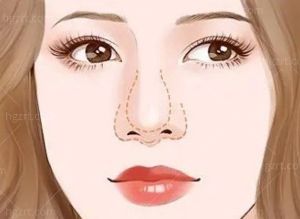 长春悦美汇整形医院隆鼻多少钱