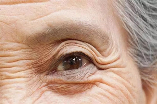 上海和平眼科医院怎么样