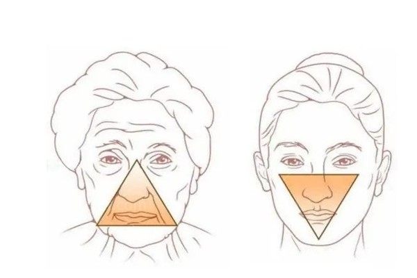 做轮廓三件套8年后想取出钛钉，想问下要多少钱