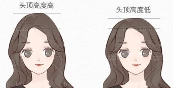 什么是骨水泥颅顶填充