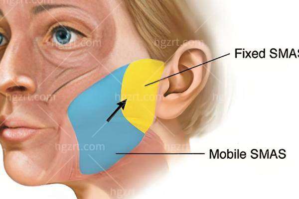 北京袁强博士拉皮面诊地址/预约/价格表