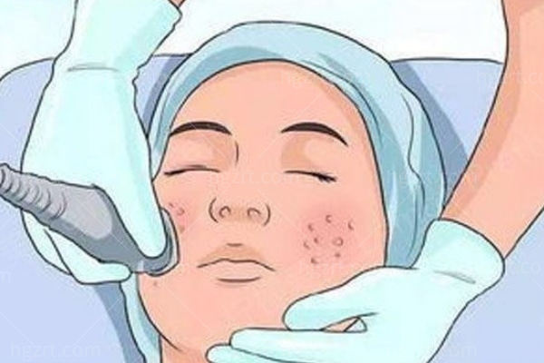 韩国清潭OK皮肤科11月价格曝光！热玛吉、超声刀、丽珠兰水光针惊爆价！