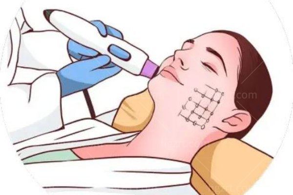 眼部热玛吉能解决什么问题？细纹/眼袋/黑眼圈等问题统统都消失