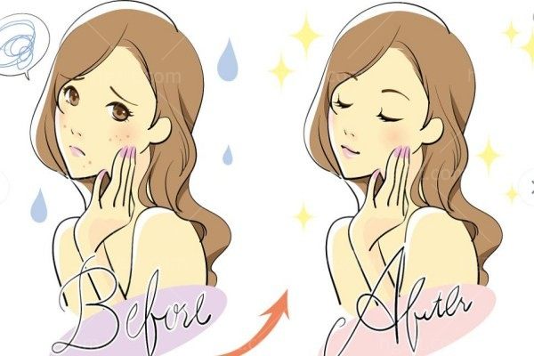 韩国德玛玻尿酸值不值得打？适合哪些部位