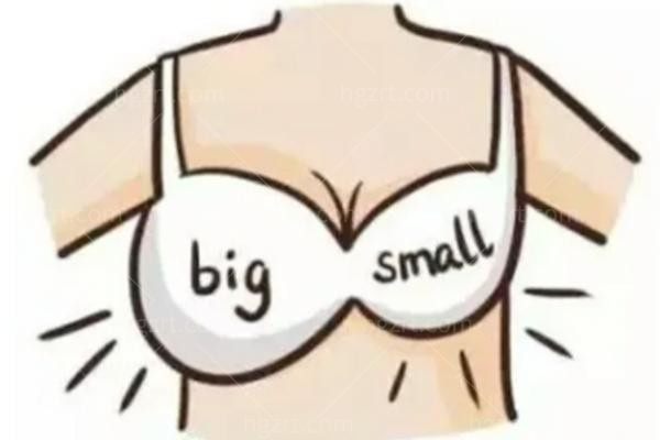 motiva隆胸会不会有水波纹？