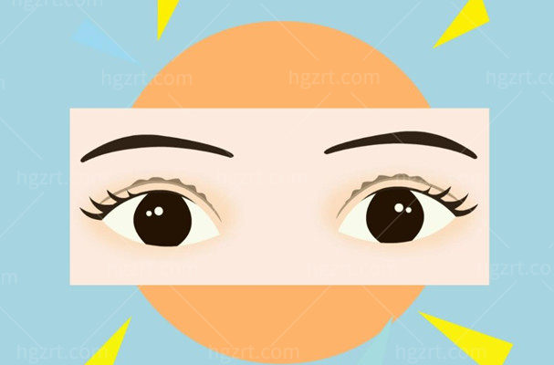 上海张园园和许炎龙双眼皮修复哪个好