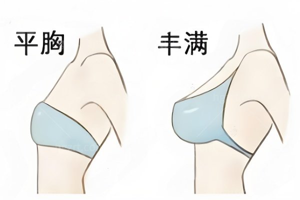 石家庄做缩胸手术好的医院公布！排名top6医院盘点：美莱/蓝山等上榜，确实值得看一看