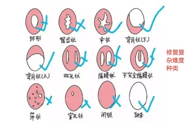 2026年深圳私密修复哪家医院好
