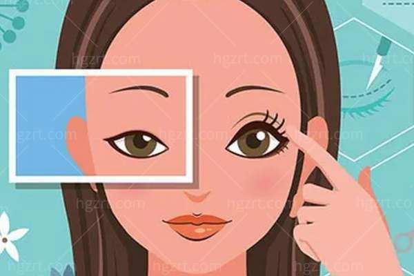 深圳做双眼皮修复好的医院排行：美莱陈芝医生/深圳富华医院割双眼皮做得好