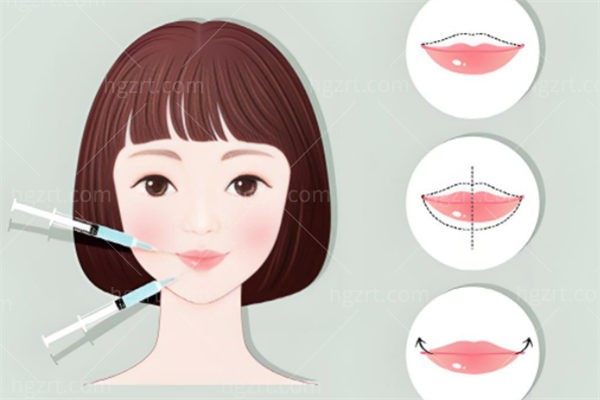 丰唇的针一般多久打一次?