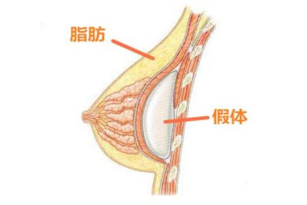 武汉艺星徐国建做胸怎么样？