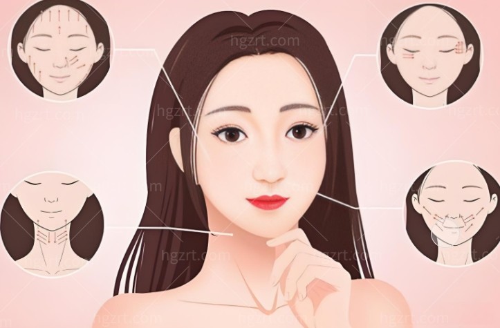 成都李建刚医美贵吗