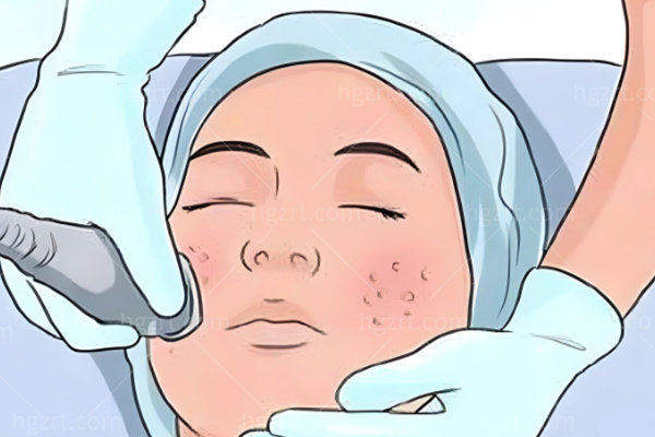 皮秒、超皮秒究竟能解决哪些皮肤问题?一篇给你讲明白！