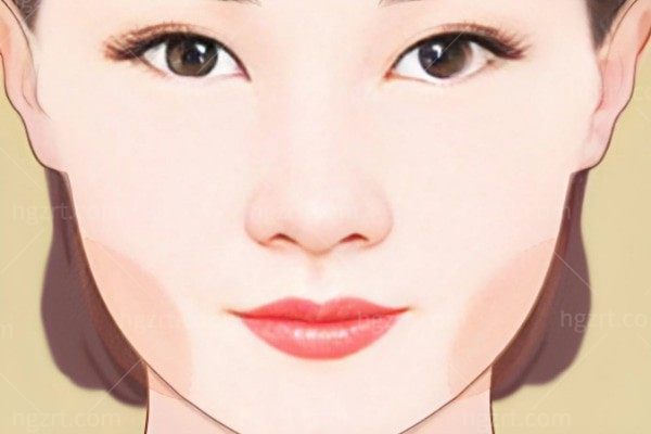 面部吸脂头套要戴多久？