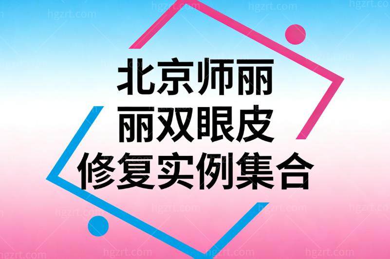 北京师丽丽双眼皮修复实例集合!修复肉条/宽改窄/闭眼痕迹消除等技术老练