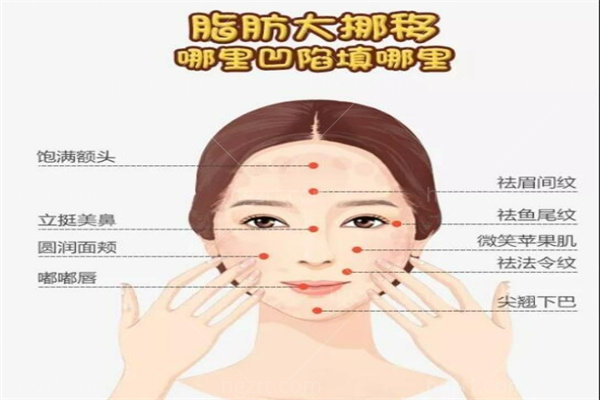 银川脂肪填充哪家做得好？技术排行榜前十名单公布