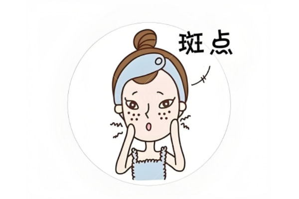 想祛斑却越祛越黑?先认清你是哪种斑,对症下药才不花冤枉钱
