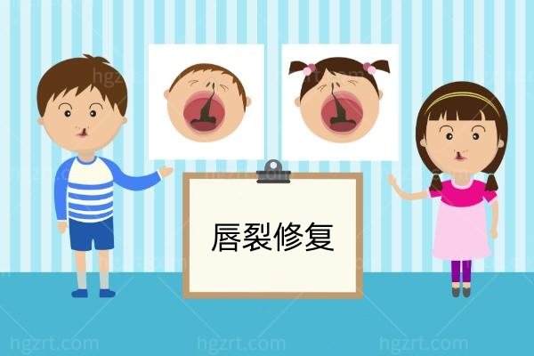唇腭裂修复多大做比较好