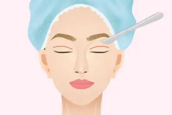 郑州十大双眼皮医生2026版!十位医生技术优势一次讲清