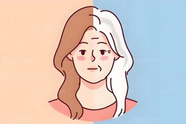 四十岁脸上肉下垂像发面馒头?筋膜提升还是线雕一篇讲透