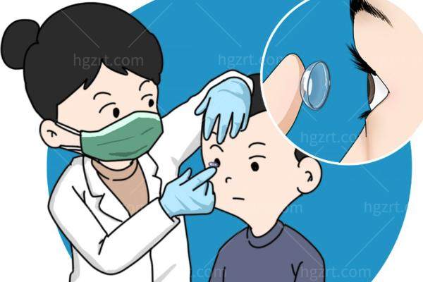 白内障怎么治